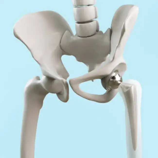 Implant Titanium Bar